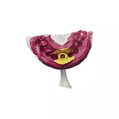 MiTi 40 Kit VPS Impression Material for Crowns, Bridges, & Veneers, 11x50/box (VMMITI-CBAK)